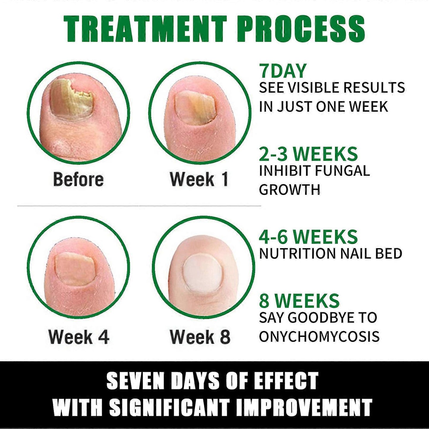 JAYSUING - TRATAMIENTO UÑAS: LA SOLUCIÓN DEFINITIVA PARA UNAS UÑAS SALUDABLES Y VISIBLES EN SOLO 7 DÍAS