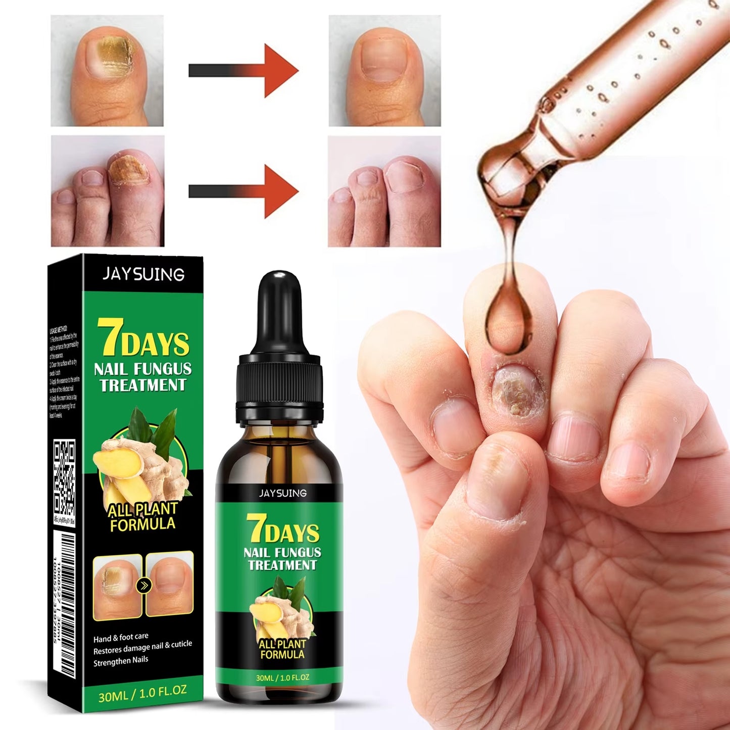 JAYSUING - TRATAMIENTO UÑAS: LA SOLUCIÓN DEFINITIVA PARA UNAS UÑAS SALUDABLES Y VISIBLES EN SOLO 7 DÍAS